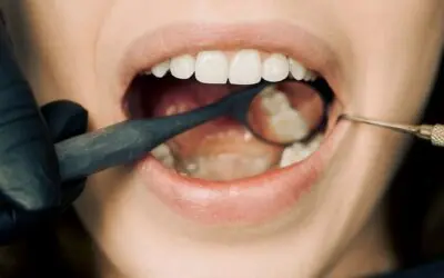 Wisdom Teeth Removal Warrnambool | Safe, Comfortable Extractions